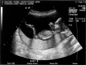 Life is good for Baby B